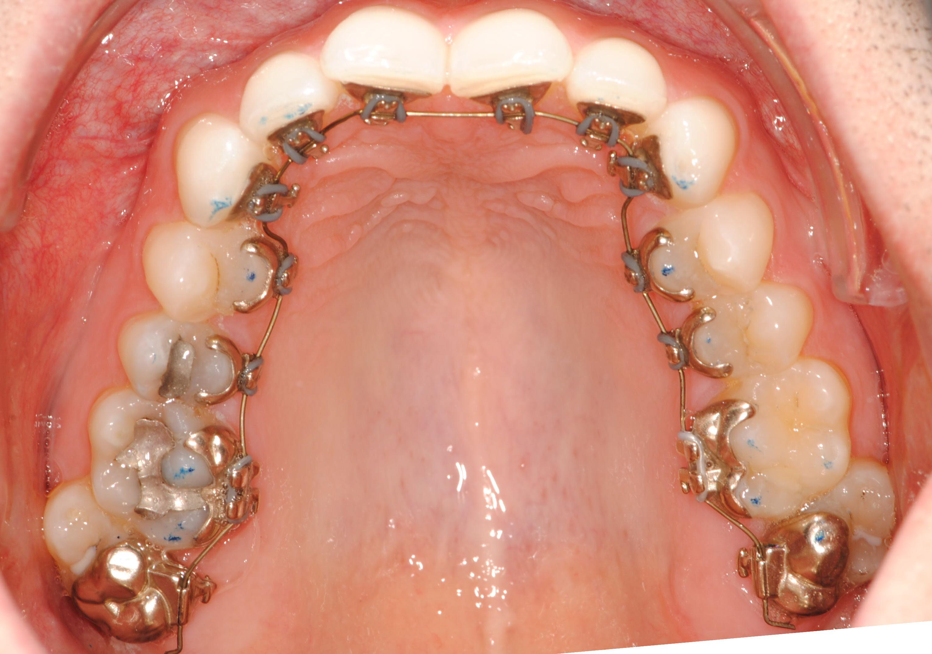 Orthodontist Gungahlin reviews