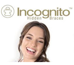 Incognito-Hidden-Braces1