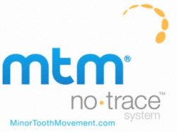 MTM-No-Trace-Braces-system