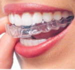 invisalign-questions-answered